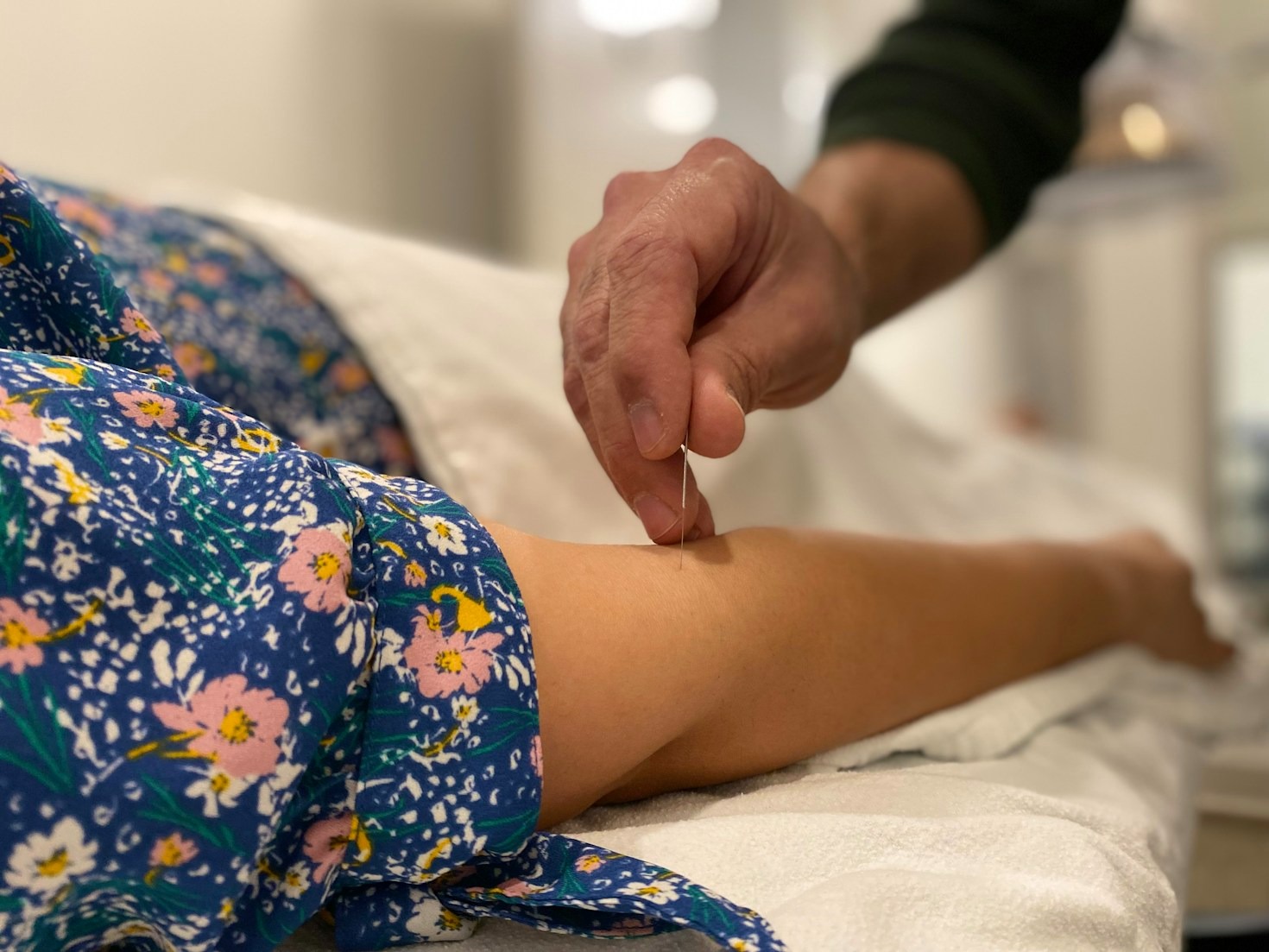 Benefícios da acupuntura para o equilíbrio do corpo